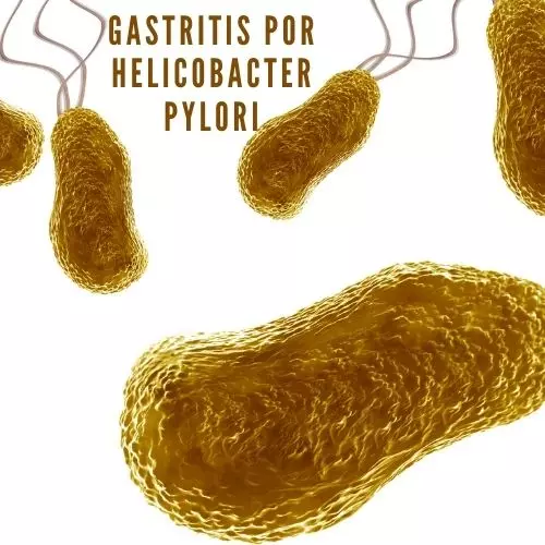 Gastritis Por Helicobacter Pylori [2022]